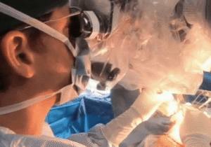 جراحی موفق تومور مغزی در حالت هوشیاری برای کودک ۱۰ ساله