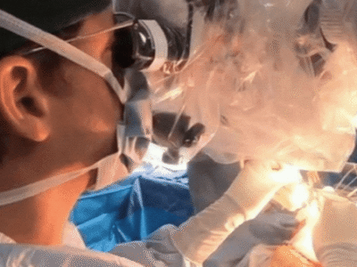 جراحی موفق تومور مغزی در حالت هوشیاری برای کودک ۱۰ ساله